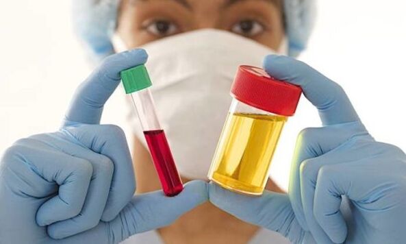 Esami del sangue e delle urine prima dell'intervento chirurgico per l'ingrandimento del seno